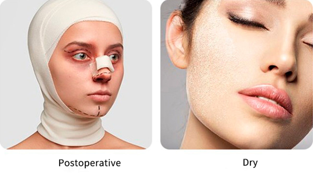 Silicone Ice Roller for Face