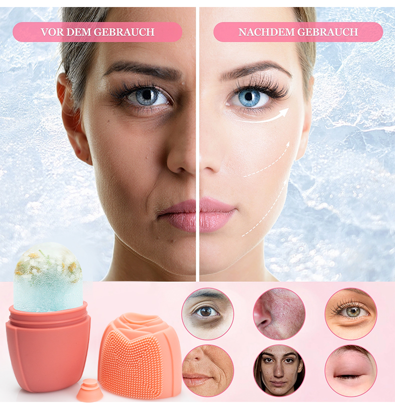 실리콘 아이스 롤러