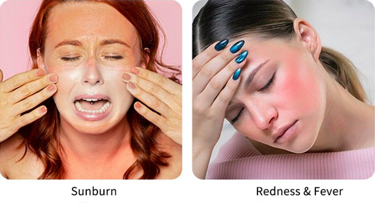 Silicone Ice Roller for Face